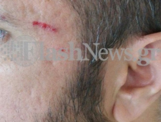 Κρήτη: Απαράδεκτη οδηγός ξυλοκόπησε ανάπηρο στου οποίου τη θέση είχε παρκάρει παράνομα (εικόνες)